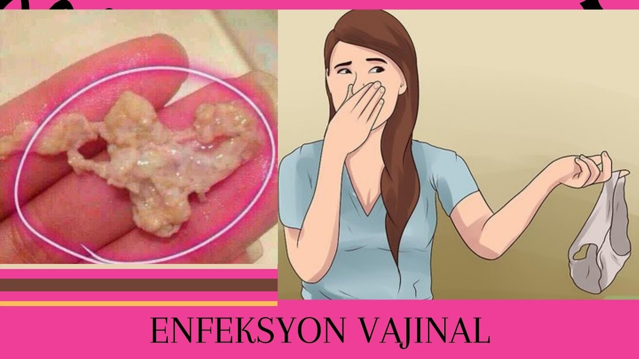KÒMAN POUW GERI ENFEKSYON VAJINAL !