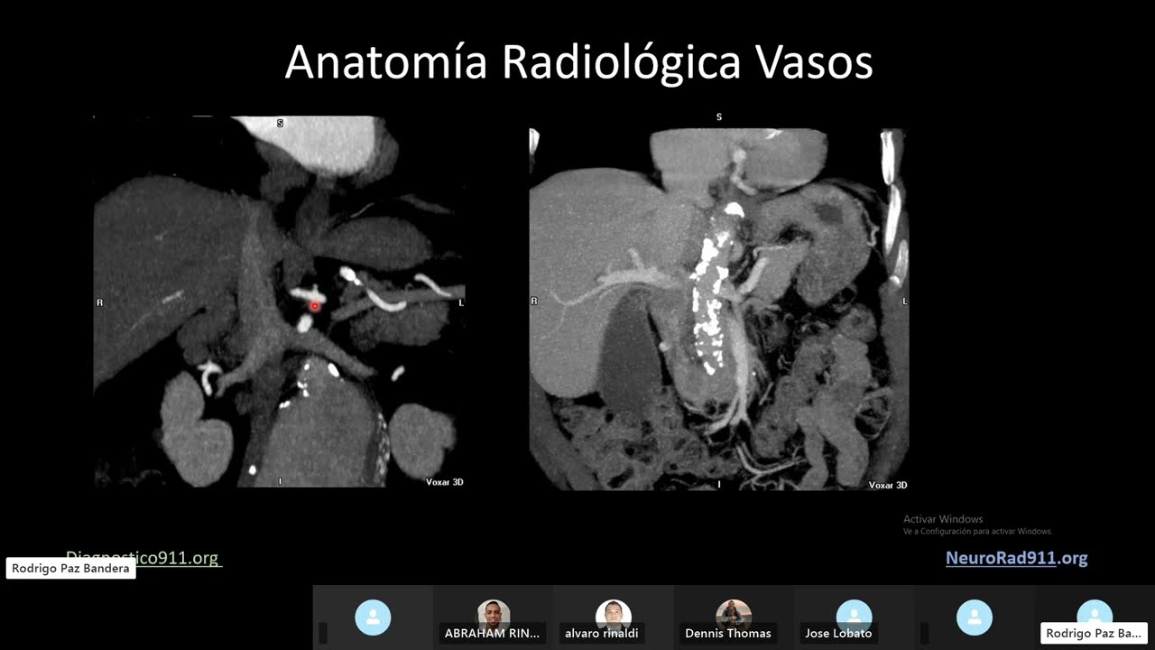 Ca Pancreas  caso clinico