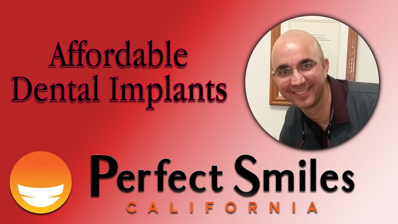Implant Dentist Chula Vista CA| Affordable Dental Implants Chula Vista CA|Dr. David Garate