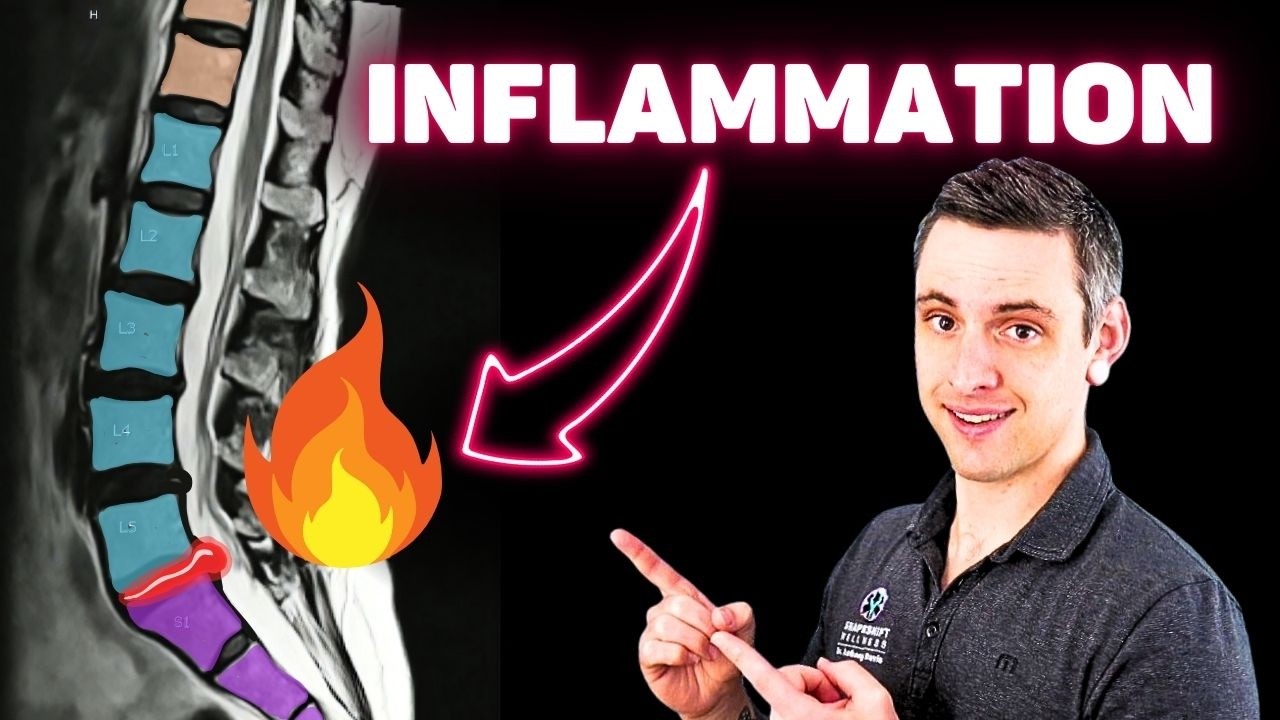 The Real ROOT CAUSE of Chronic Back Pain (pt.5) - Spine Inflammation (Peripheral Sensitization)