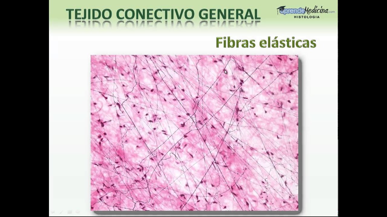 Fibras Reticulares  y Elasticas