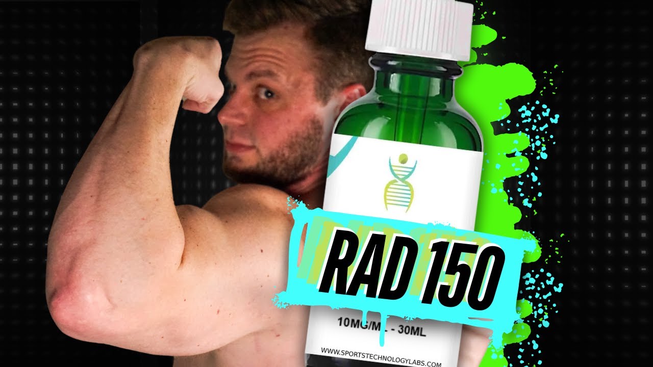 Rad150 - The Good, The Bad, The Ugly (Fully Explained)