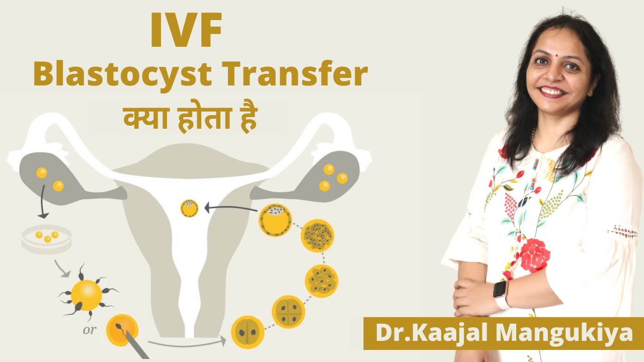 IVF Blastocyst Transfer क्या होता है | Dr.Kaajal Mangukiya