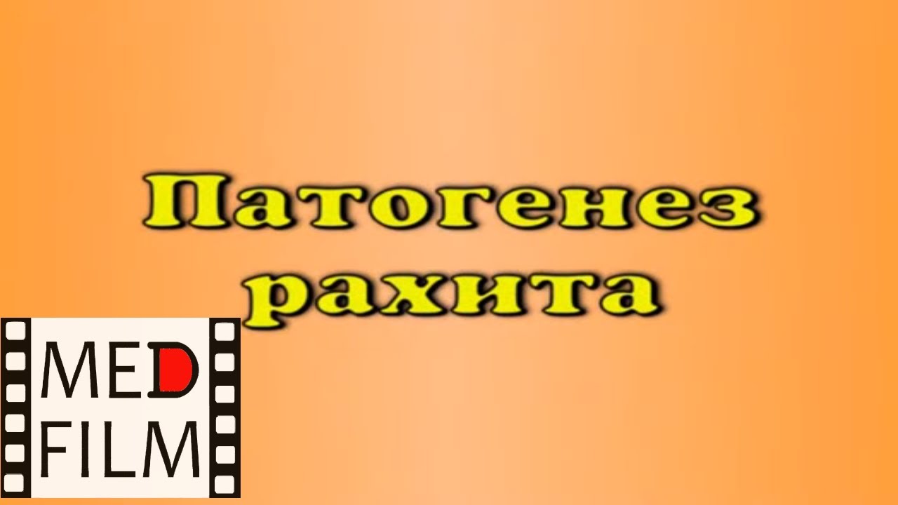 Патогенез рахита © The pathogenesis of rickets