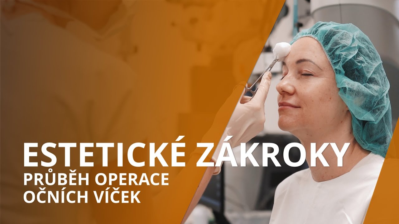 Estetické zákroky: Průběh operace očních víček