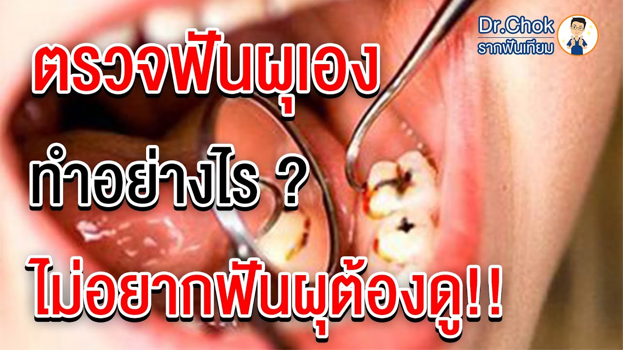 EP.2 | ตรวจฟันผุง่ายๆ ด้วยตัวเองทำอย่างไร ? ไม่อยากฟันผุต้องดู  ? | คลายปัญหารากฟันเทียมกับหมอโชค
