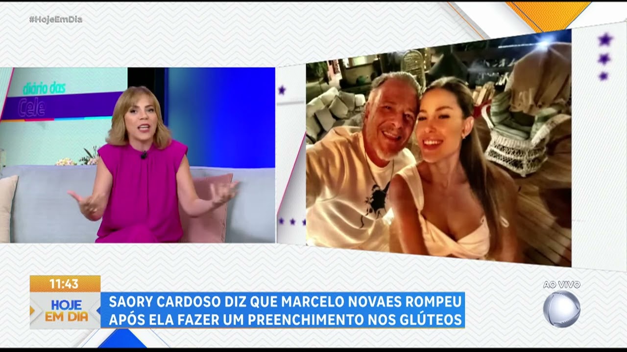 HOJE EM DIA: Marcelo Novaes termina com Saory Cardoso após procedimento estético