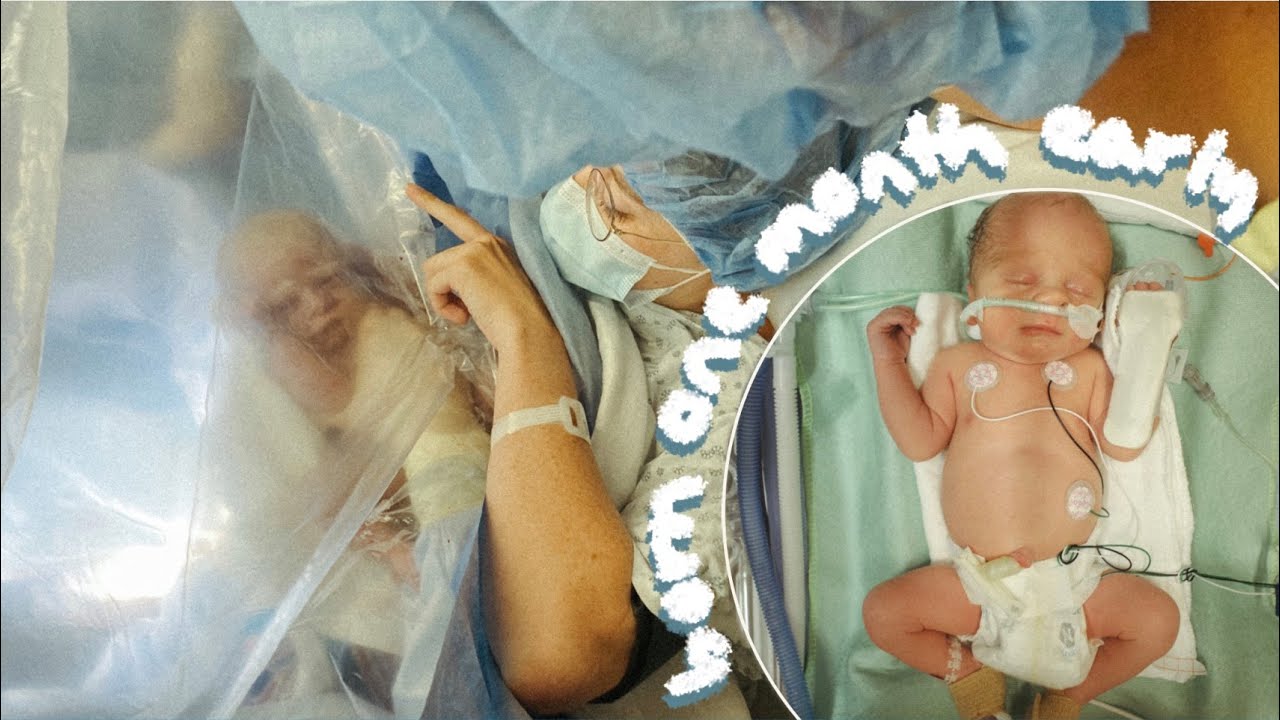 Diagnosed With A Rare Condition (Vasa Previa) // MY BIRTH STORY