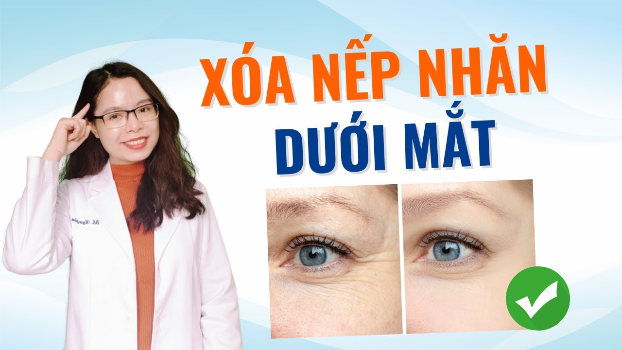 Nếp nhăn dưới mắt không còn với 5 cách đơn giản này - Bác sĩ Nguyên
