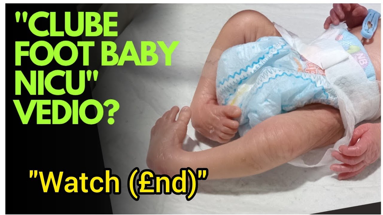 Tiny Fighter Baby with Clubfoot | First Common Care & Referral to Large Hospital 💪👶..