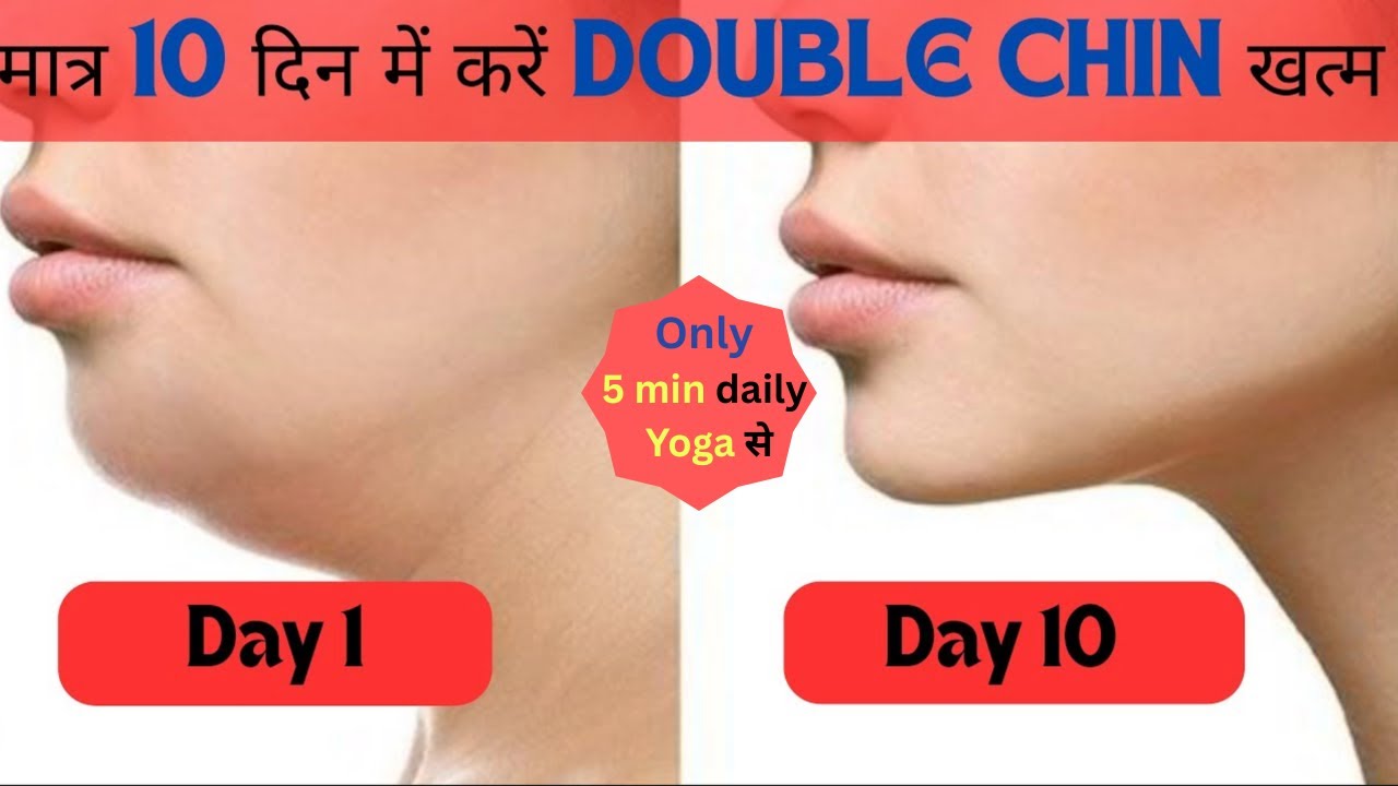 Double Chin Fat Remove Naturally in Just 5 Minutes | Face Yoga at Home