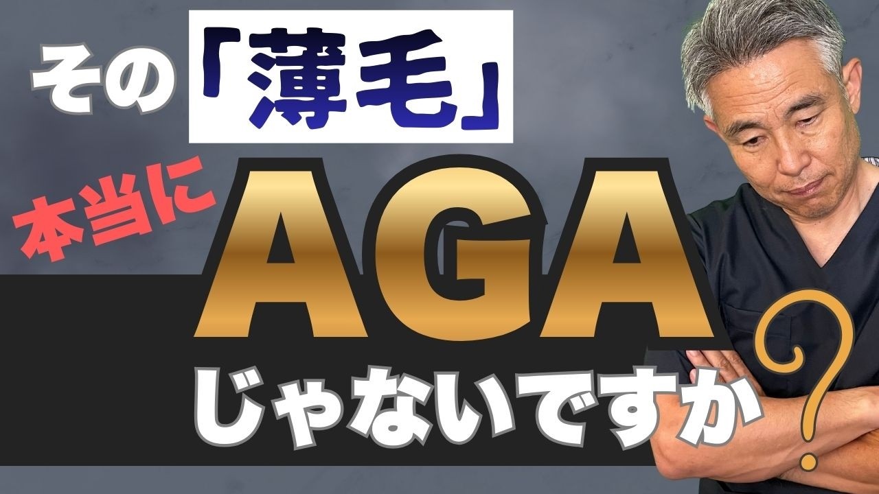 AGAではないと思っている方のAGA判断の方法