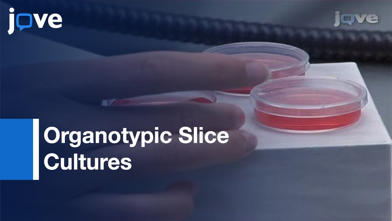 Analysis- Purkinje Cell Dendritic Morphology: Organotypic Slice Cultures l Protocol Preview