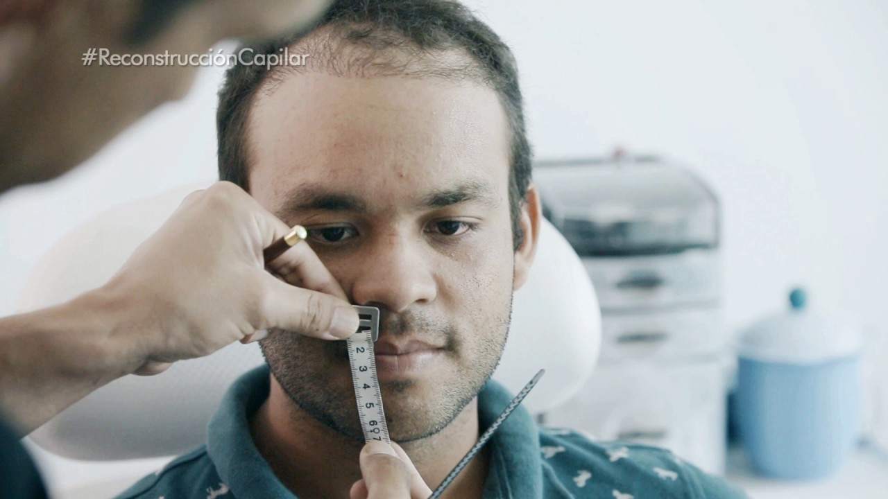 Gervis Gómez - Trasplante Capilar René Rodríguez Medical