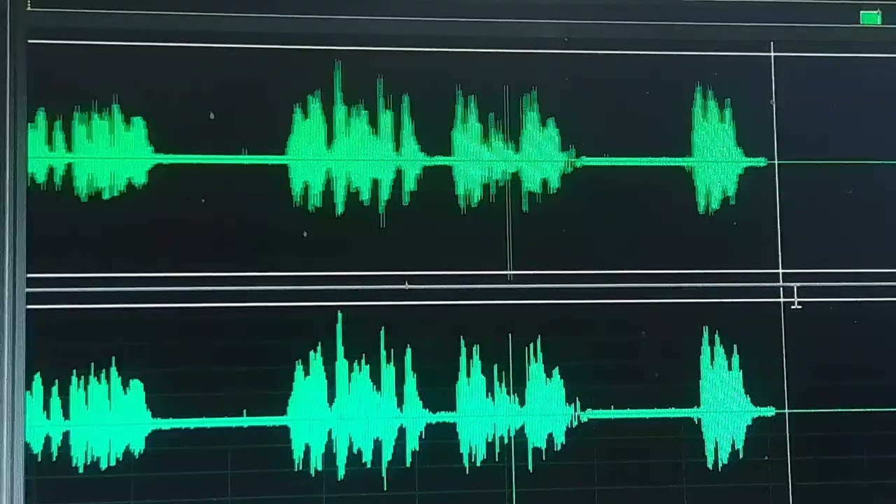 Kasese District Veterinary Officer Dr. Yusuf about health of animals. 