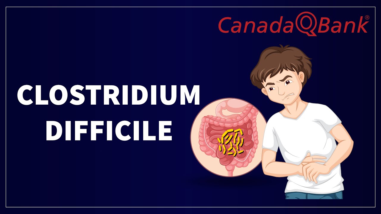 Clostridium Difficile Infection: Causes, Symptoms & Treatment | C. diff Explained | CanadaQBank
