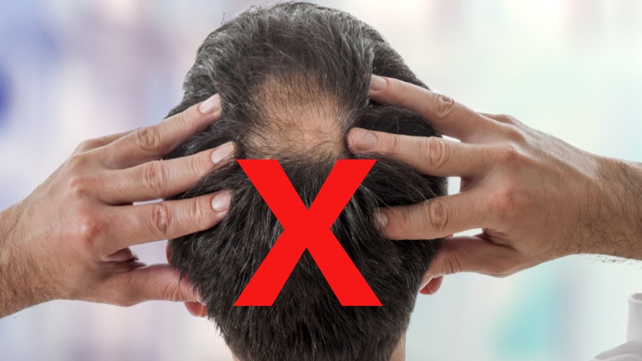 Why scalp massages do NOT stop hair loss
