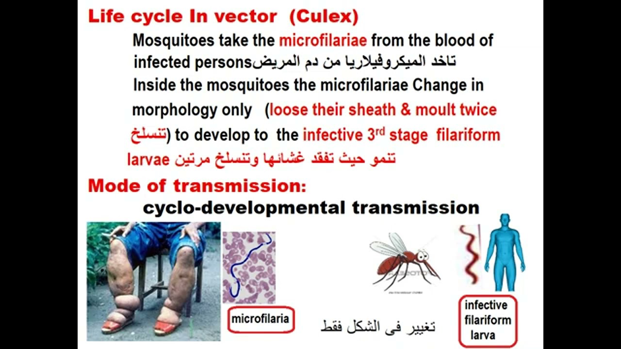 Parasitology Blood Module Filaria  Wucheraria bancrofti