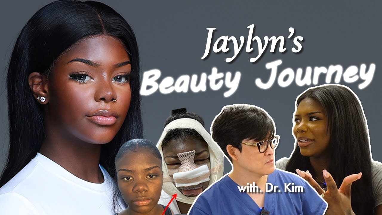 I Changed My Entire Face… (Full Plastic Surgery Journey)