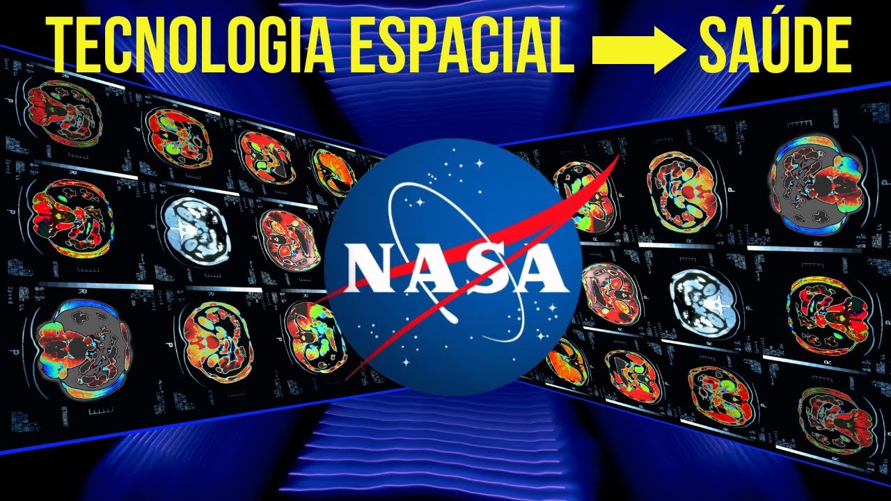 NASA - A TECNOLOGIA ESPACIAL EM BENEF&Iacute;CIO DA SA&Uacute;DE HUMANA