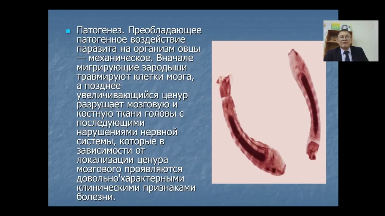 Паразитология и инвазионные болезни 1. Лекция 6. Церебральный ценуроз