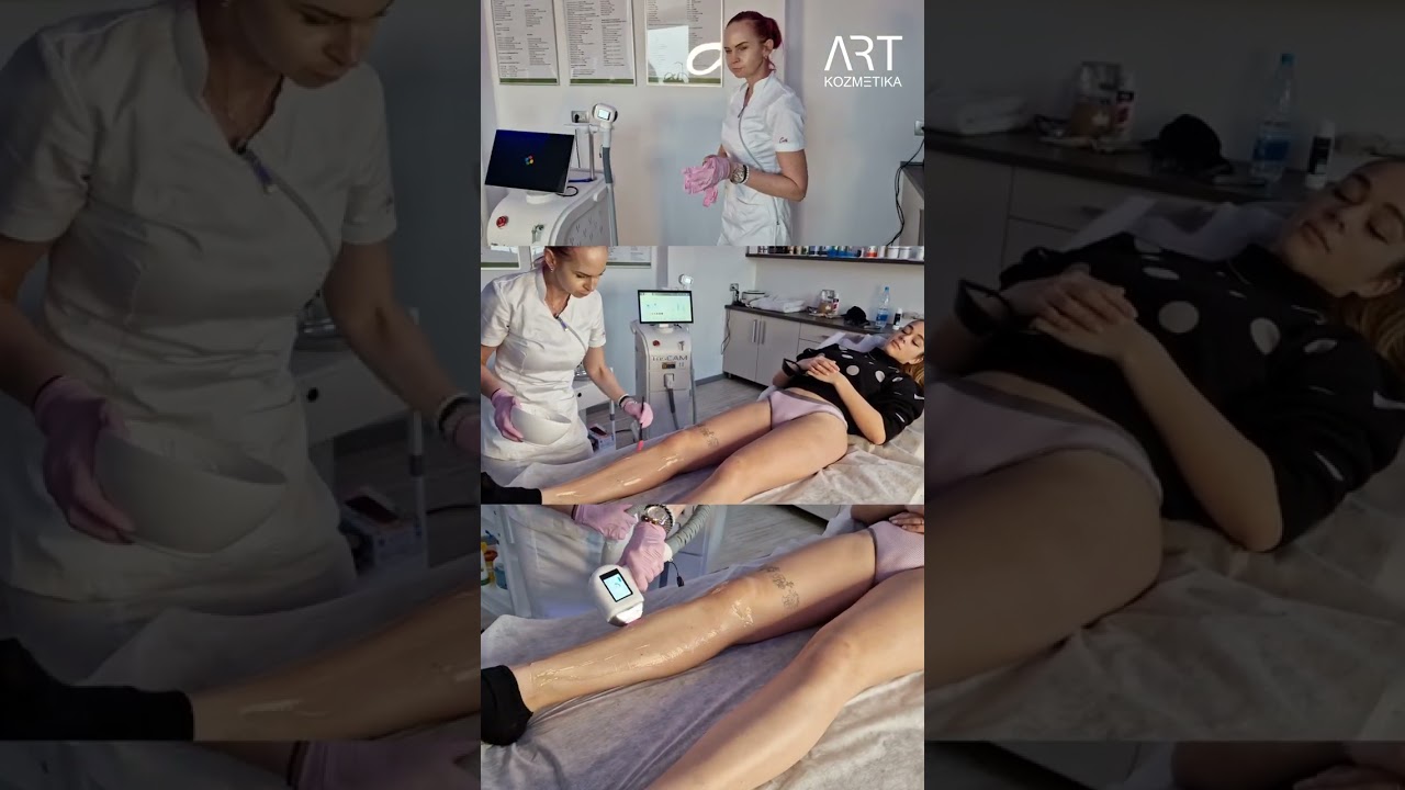 Se odločaš za nakup Diodnega laserja❓ Potem je za video ravno za tebe