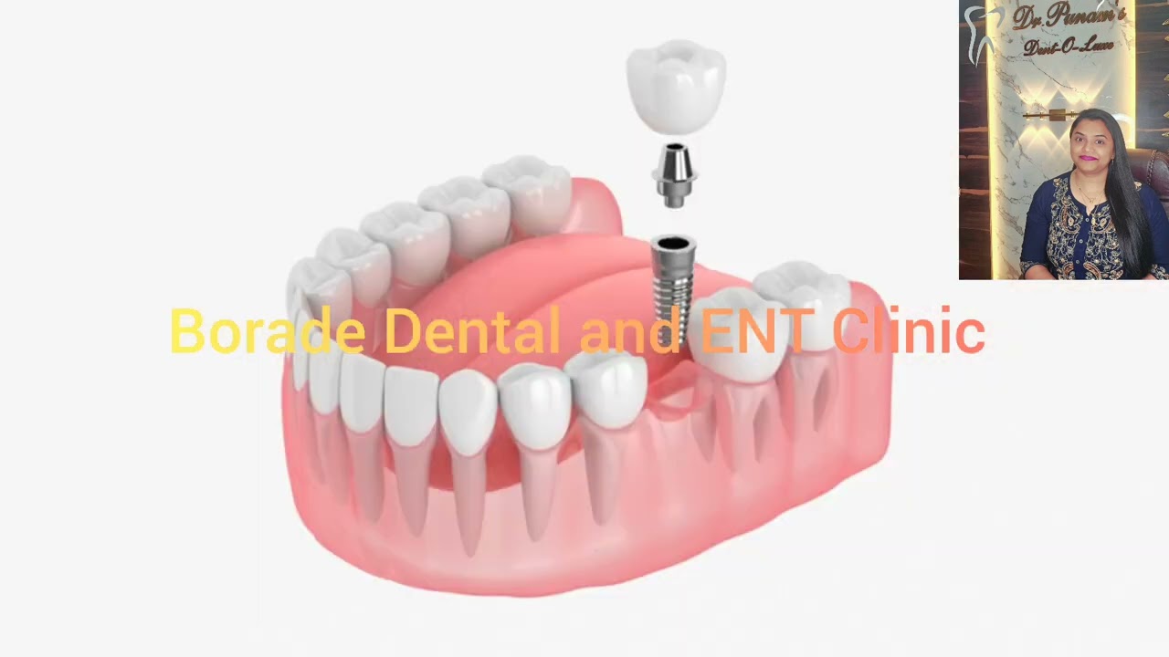 Borade Dental  Facial cosmetic and ENT Clinic