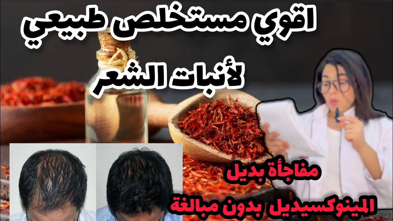 اقوي مستخلص طبيعي بديل للمينوكسيديل لاستعادة الشعر وعلاج الصلع من اول شهر !بالنتائج والصور |فرح محسن
