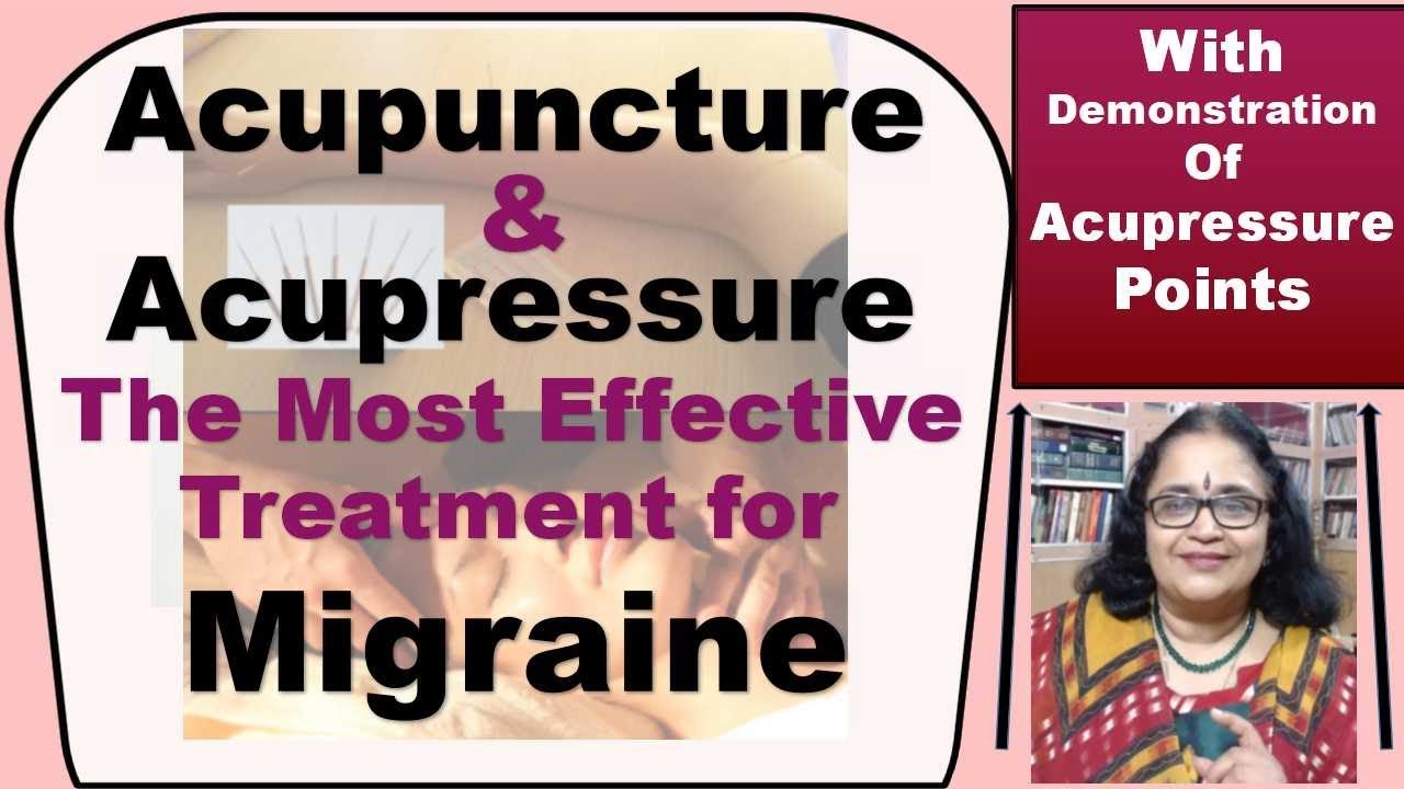 Get Instant Relief From  Migraine With Acupuncture & Acupressure (With Demo Of The Points)