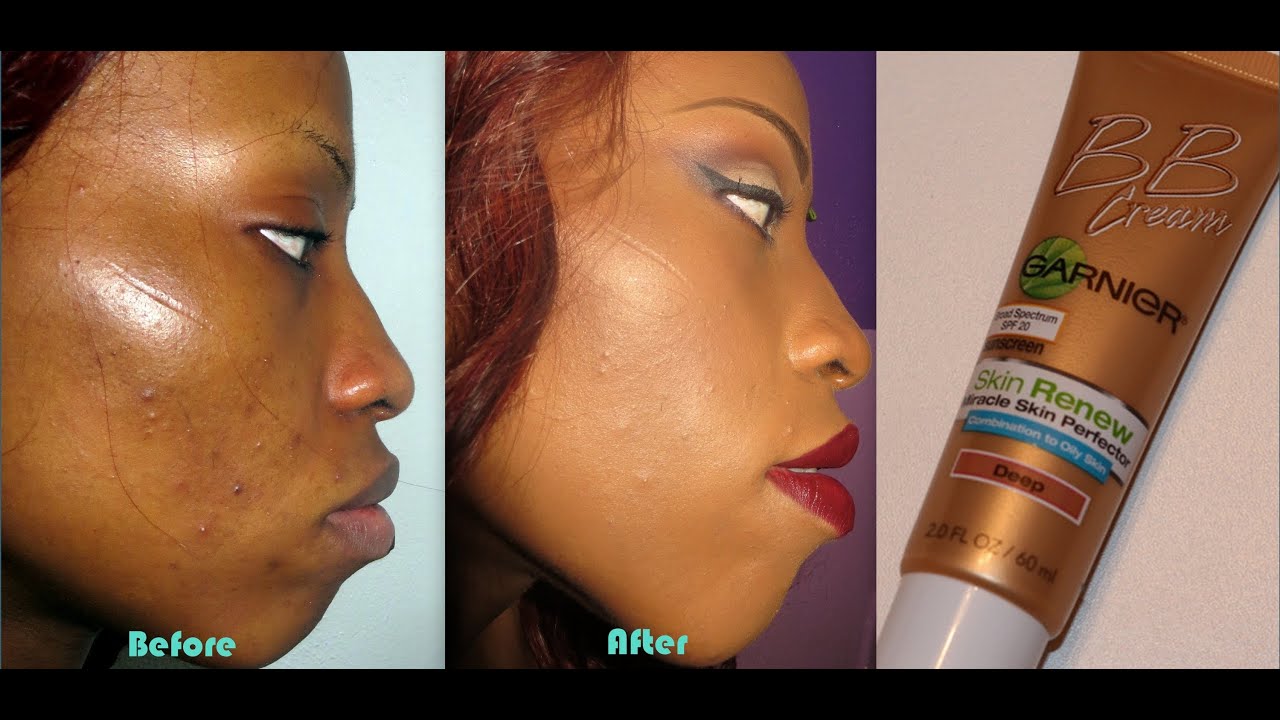 New! Garnier Skin Renew BB Cream For Oily/Combo Skin: Demo & Review