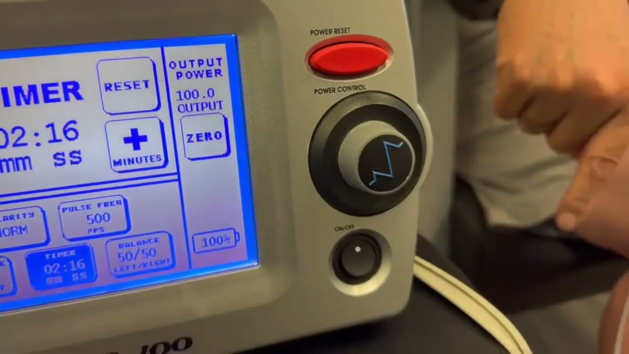 How ARPwave Healed Achilles Tendon Pain