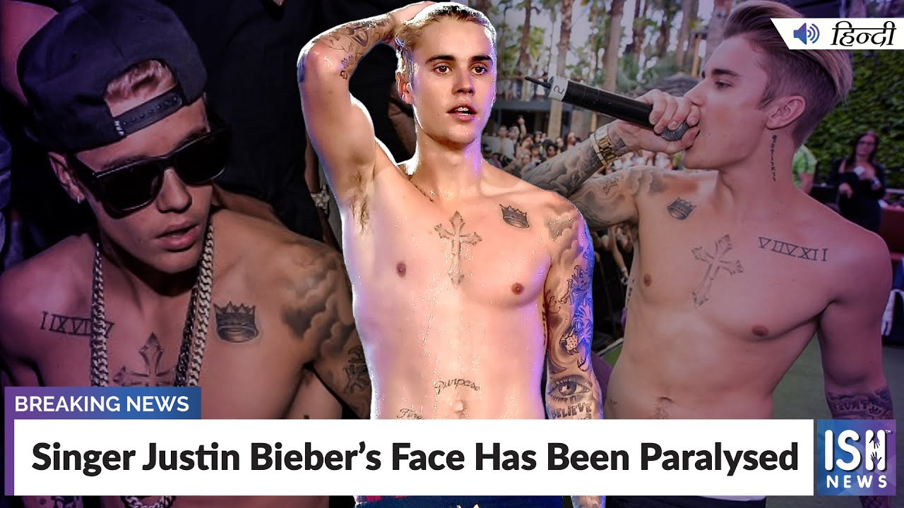 Singer Justin Bieber’s Face Has Been Paralysed | ISH News