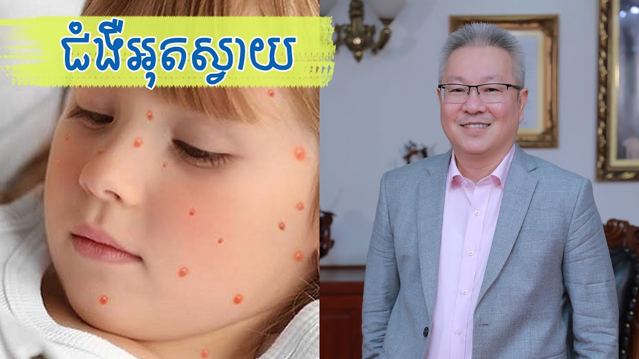 យល់ដឹងអំពីជំងឺអុត​ស្វាយ​និងវិធីព្យាបាល