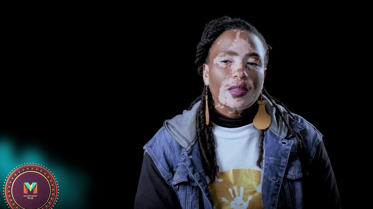 Stigmatized because of vitiligo – Chozi | S1 | EP21 | Maisha Magic Plus