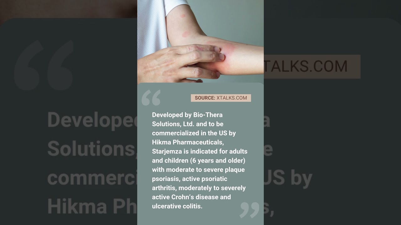 Starjemza (Ustekinumab) FDA Approval: 2025&rsquo;s First Biosimilar for Stelara in Psoriasis Care