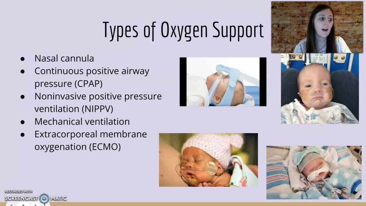 The OT's role in the NICU