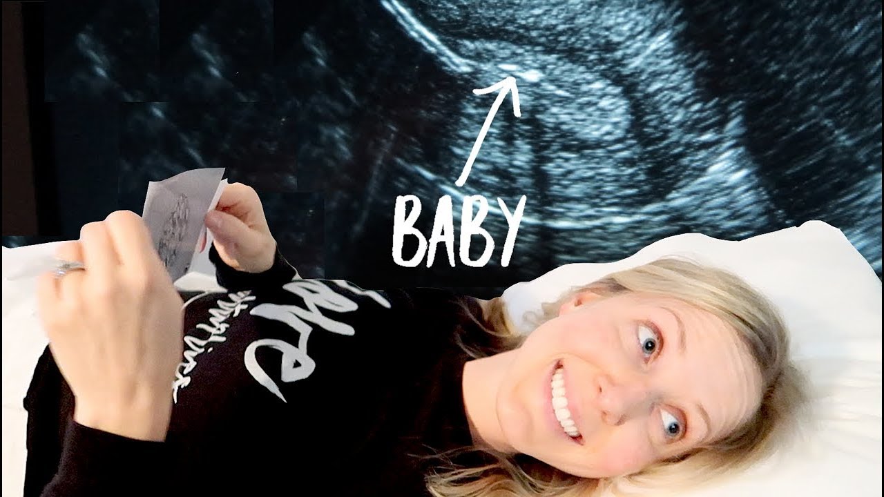 MOST SUCCESSFUL IVF EMBRYO TRANSFER (FET)