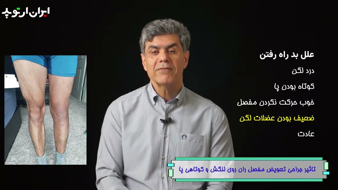 تاثیر جراحی تعویض مفصل ران بر لنگش چیست