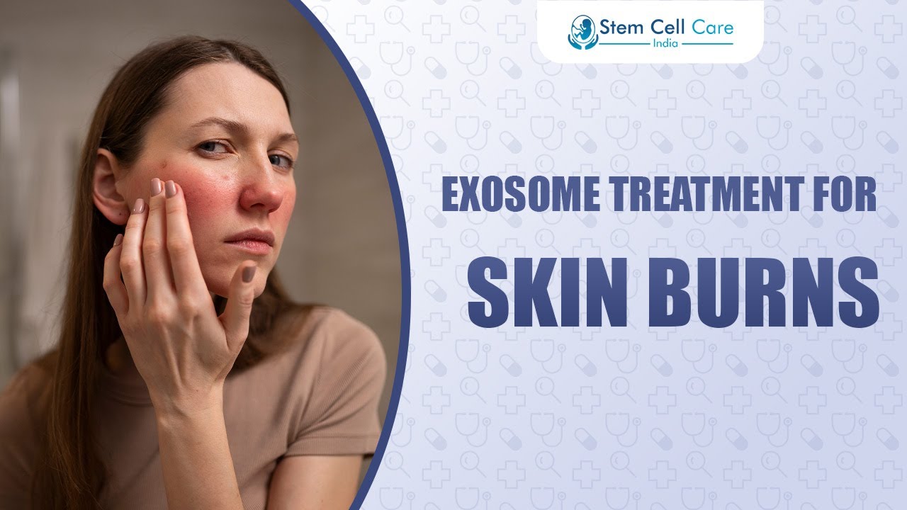 How Exosomes Transform Skin Burn Treatment | Regenerative Medicine Explained |