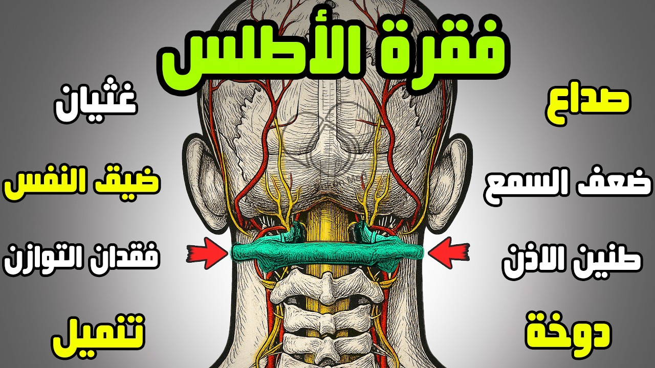 الأطلس | محور الأعراض العصبية الغامضة | صداع, تنميل، دوخة, زغللة، طنين، غثيان, التوازن, إغماء مفاجئ