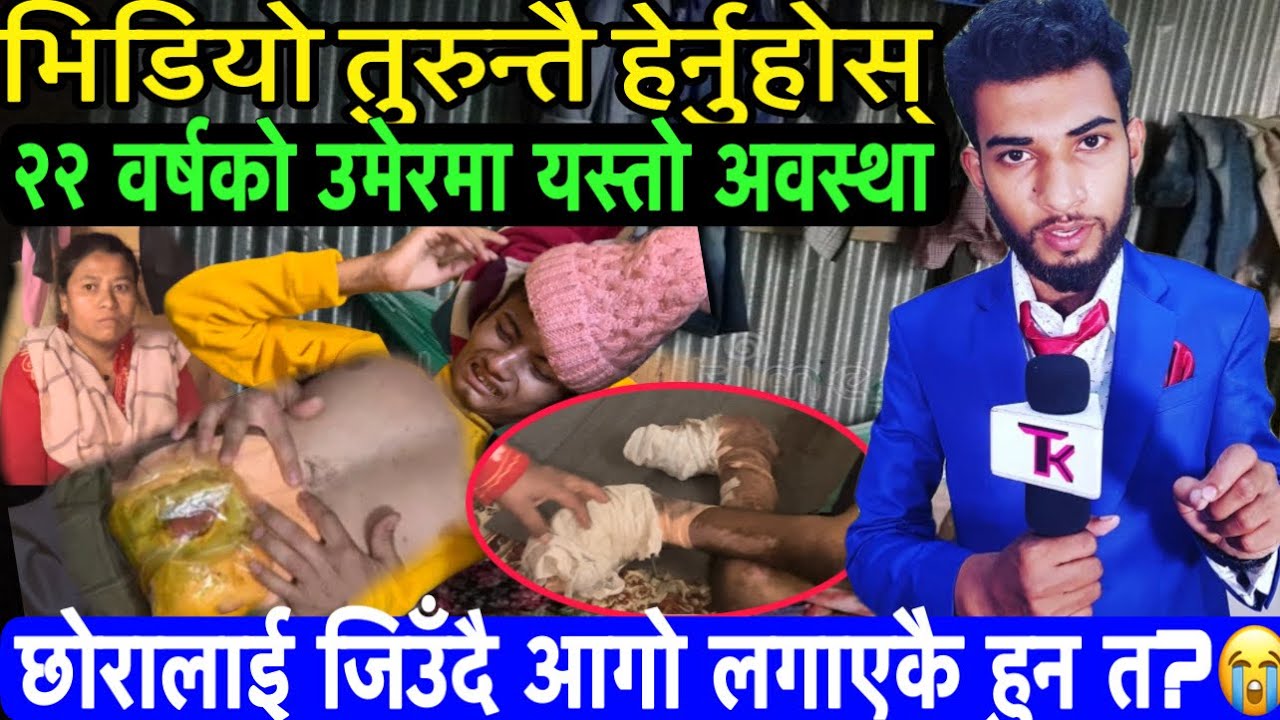 Bhagya Neupane News || Bhagya Neupane Tattato khabar