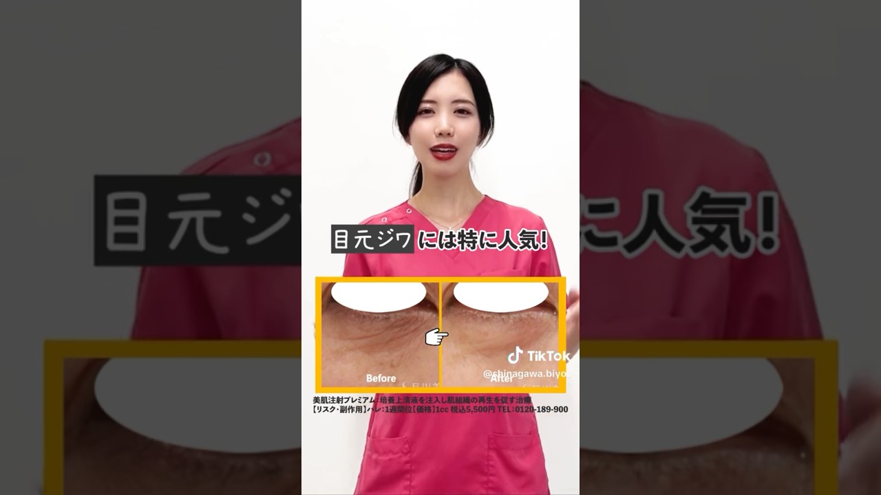 シワ改善 にオススメの治療3選　#shorts #品川美容外科 #品川スキンクリニック #美容 #エイジングケア