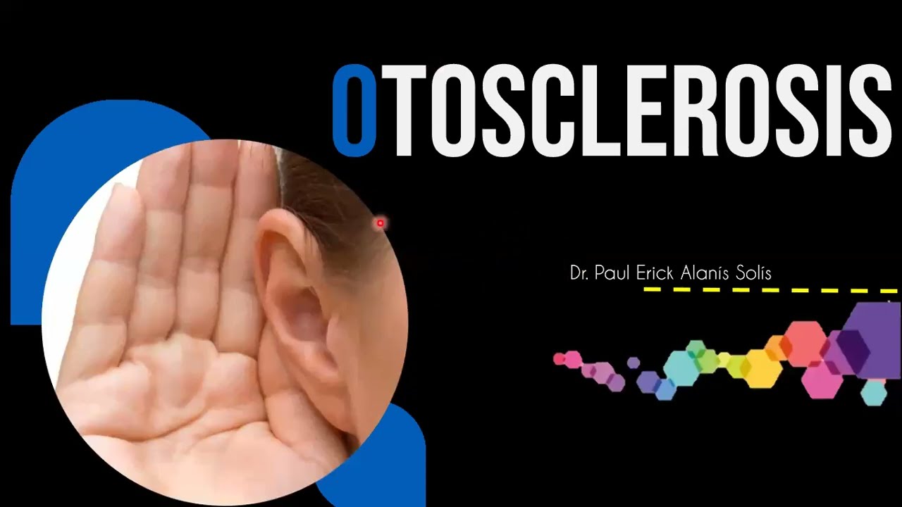 Otosclerosis