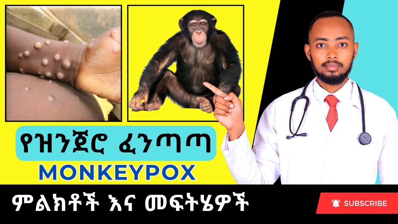 Ethiopia: የዝንጀሮ ፈንጣጣ ቫይረስ (MONKEYPOX) በሽታ ምልክቶች እና መፍትሄዎች