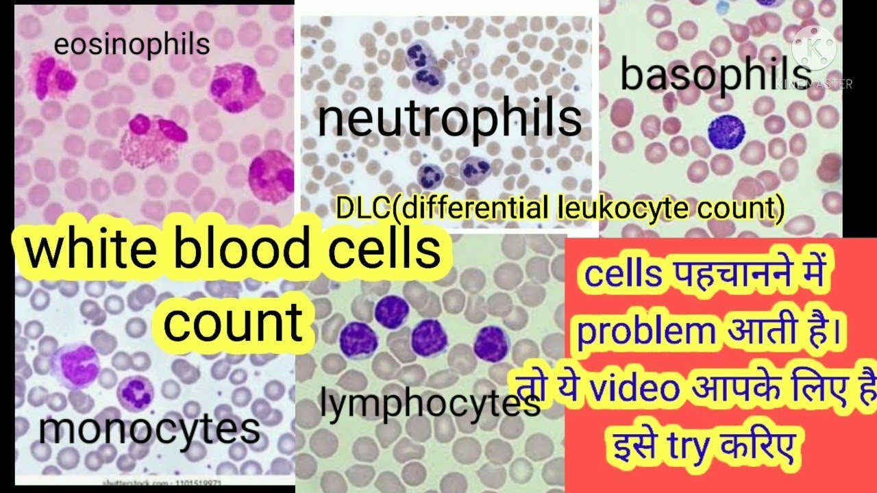 blood test differencial leukocytes count | DLC count sabse sahi tarika I dlc count in microscope