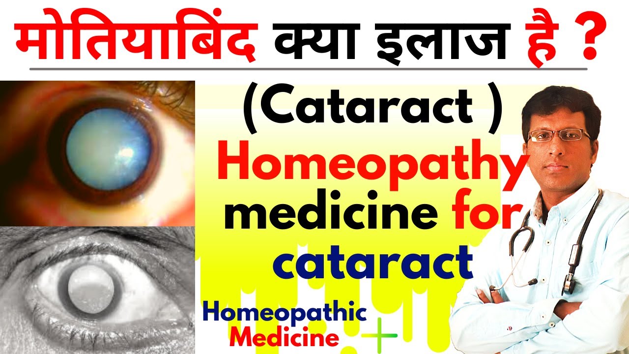 मोतियाबिंद क्या है मोतियाबिंद  इलाज  Homeopathy medicine for cataract cure Cataracts Hindi Dr.Mahesh