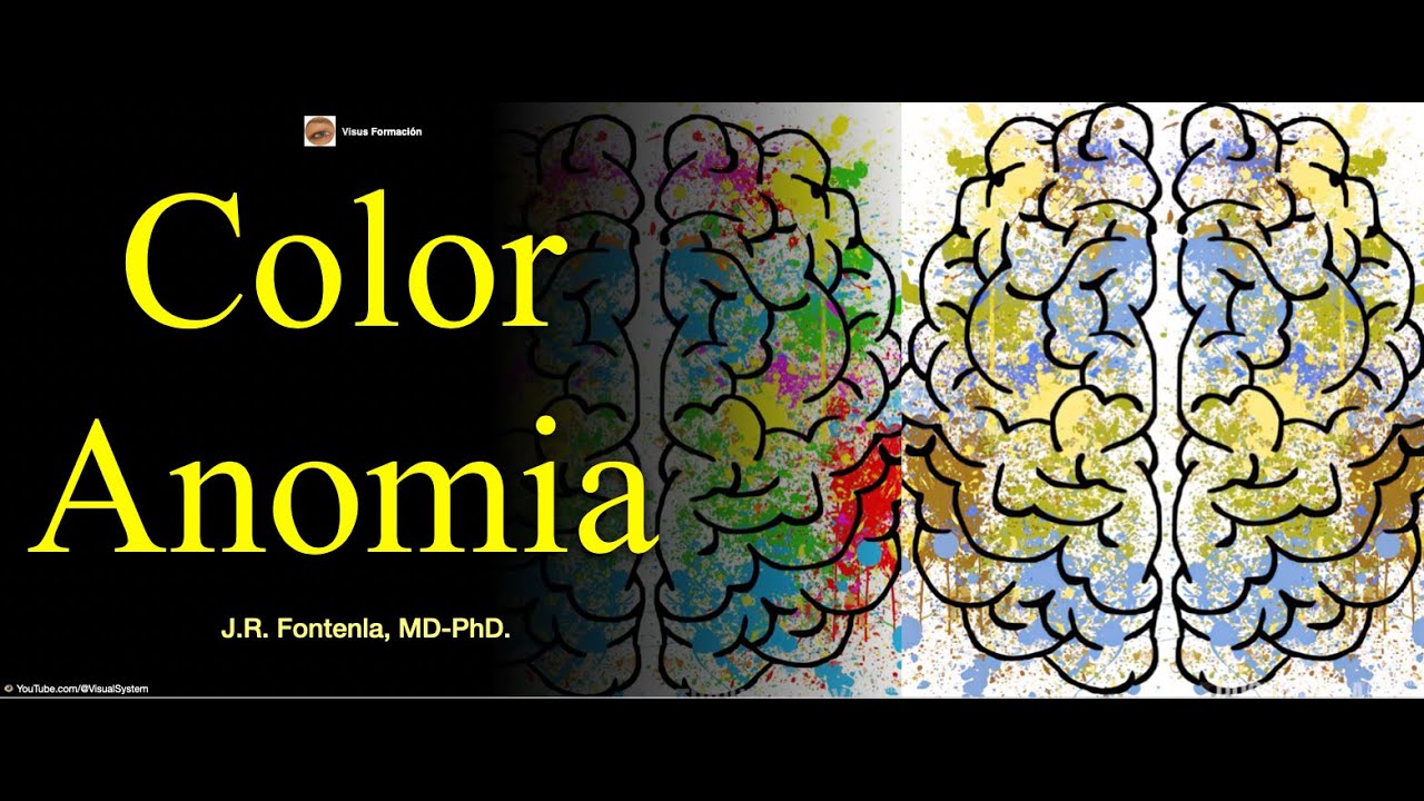 Color Anomia.