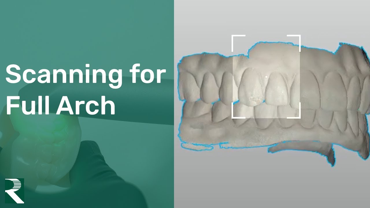 Scanning for Full Arch - Different Scanning Scenarios