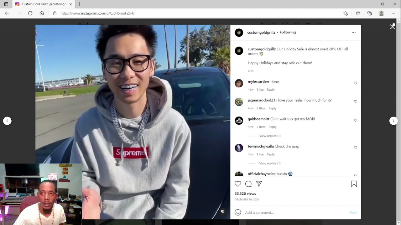 (Custom Gold Grillz Review) are they grills worth it???