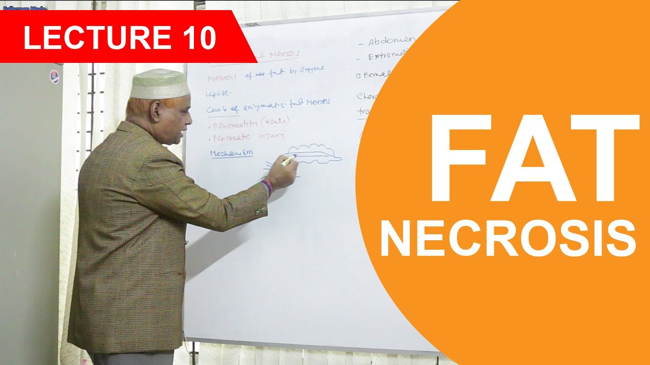 General Pathology: Lecture 10 | Fat Necrosis & Caseous Necrosis